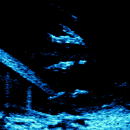 DIDSON sonar image of salmon swimming out of the Ballard Locks near Seattle, Washington.
