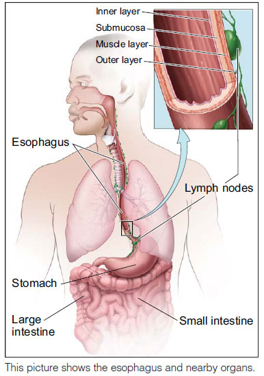 This picture shows the esophagus and nearby organs.