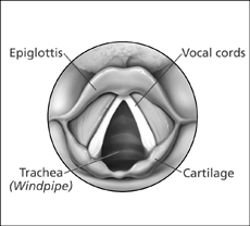 Illustration shows the epiglottis, trachea, and vocal cords.