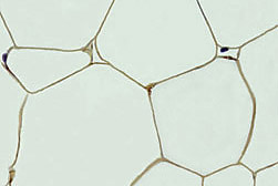 Photo: Fat tissue from a mouse. Link to photo information