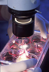 Photo: Cells are observed for indications of swine influenza virus.