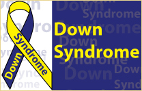 Down Syndrome.