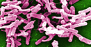 Micrograph depicting Gram-positive C. difficile bacteria from a stool sample culture