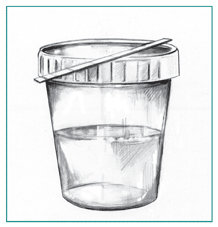 Drawing of a urine sample in a cup and a dipstick for testing the protein content of the urine.