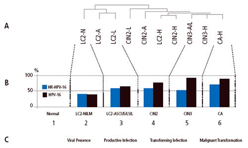 Figure 2. Disease stages identified in the SUCCEED population based on histology, cytology, and HPV genotyping. (A) Dendrogram of histology-cytology combination clustered by HPV genotype frequencies. (B) Viral load by disease stage: (1) women with normal histology, normal cytology, and HPV negativity; (2) HPV-positive women with < CIN2-NILM and low-level viral activity; (3) HPV-positive women with productive viral infections; (4) CIN2; (5) CIN3; and (6) cancer. (C) Functional viral-host interaction during cervical carcinogenesis correlating to the findings in the SUCCEED population. [A: atypical squamous cells of undetermined significance (ASCUS); H: high-grade squamous intraepithelial lesion (HSIL); L: low-grade squamous intraepithelial lesion (LSIL); LC2: < CIN2; N: negative for intraepithelial lesion or malignancy (NILM).] HPV types are grouped by species. (Wentzensen N, et al. 2009)
