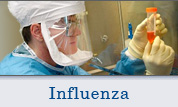 Influenza