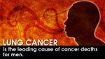 Lung Cancer is the Leading Cause of Cancer Death in Men Health-e-Card