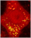 Image of yellow dots in red brain cell.