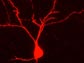 Photo of a rat neuron filled with an agent.