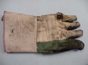 Figure 1. Glove damaged by leaking torch