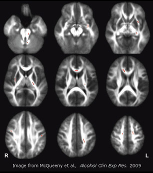 Series of MRI Scans of the Brain