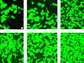 The faster endothelial cells (green) form a single smooth layer, the less chance exposed metal will provoke an immune response. Samples examined after 1, 3 and 5 days (left to right) show better coverage on nanotextured titanium (bottom row) than on conventional microstructured titanium. Photo credit: Thomas Webster
