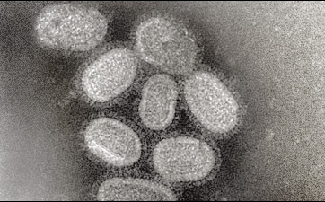 This negative stained transmission electron micrograph (TEM) shows recreated 1918 influenza virions that were collected from supernatants of 1918-infected Madin-Darby Canine Kidney (MDCK) cells cultures 18 hours after infection.