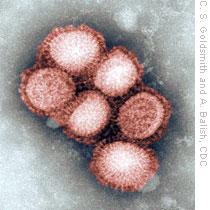 Negative stain EM image of the swine influenza A/CA/4/09
