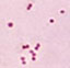 This micrograph depicts the presence of aerobic Gram-negative Neisseria meningitidis diplococcal bacteria; Mag. 1150X.