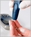 Photo of a finger-prick test for diabetes.