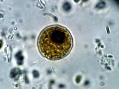 Chlamydomonas