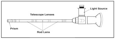 Image of a cystoscope with parts labeled.