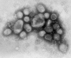 Imagen del virus de la influenza H1N1  