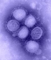 Imagen del virus de la influenza H1N1  