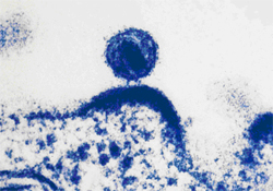 micrograph of HIV
