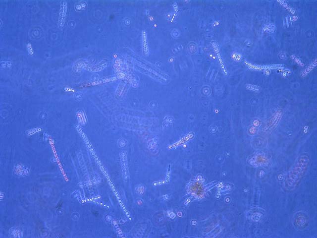 [Local Kodiak diatoms, algdiatom.jpg=29KB]