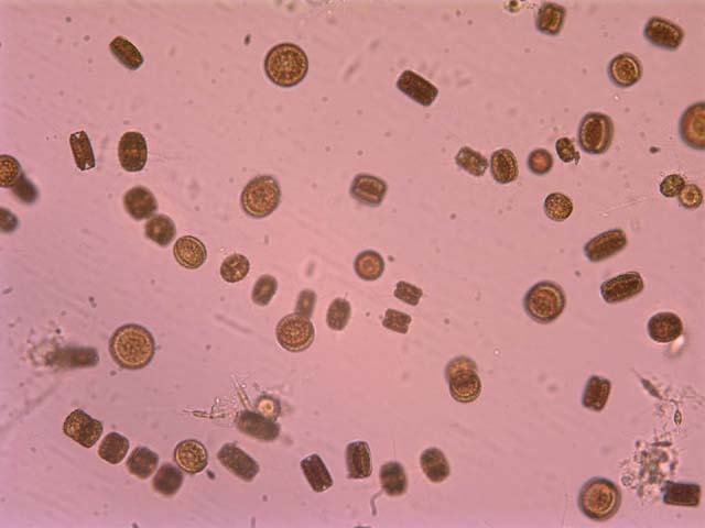 [Local Kodiak diatoms, alglocdias.jpg=25KB]