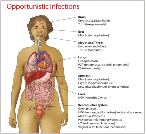 Opportunistic Infections