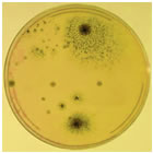 mold spores in a petri dish