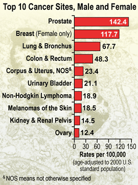Chart: Top 10 Cancer Sites, Male and Female