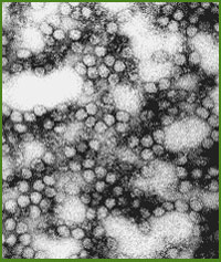 Yellow Fever Virus