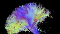 A diffusion spectral imaging (DSI) scan of the bundles of white matter nerve fibers in the brain. The fibers transmit nerve signals among brain regions and between the brain and the spinal cord.