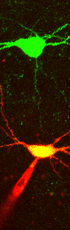 Sodium Channels Bring Variety to Inhibitory Interneurons 