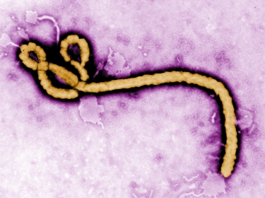 Some of the ultrastructural morphology displayed by an Ebola virus virion in an undated handout colorized transmission electron micrograph (TEM)