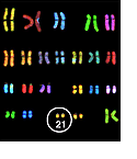 Image of chromosomes highlighting chromosome 21