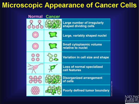 Microscopic Appearance of Cancer Cells