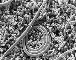 Scanning electron micrograph image of Salmonella enteritidis. Link to photo information