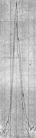 The massive mortality due to the influenza epidemic in October of 1918 in Kansas