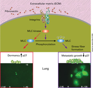 Letting Sleeping Micrometastases Lie