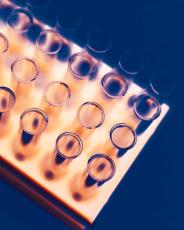 Photograph of test tubes in a tray