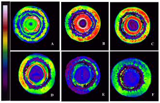 Picture of MRI of germination test