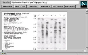 RFE Page 4 IEF Gel image