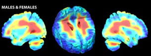 White matter growth in healthy controls