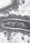 Isolation of Candidatus Bartonella melophagi from Human Blood