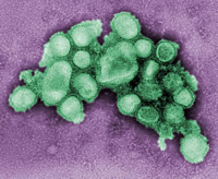 Negative stain EM image of the swine influenza