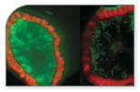 Image of CCR Connections front page: Seeing Cancer.