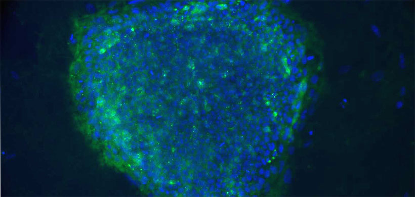 Human embryonic stem cells.