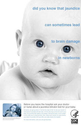 Did you know that jaundice can sometimes lead to brain damage in newborns poster