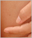 Close-up photo of human skin.