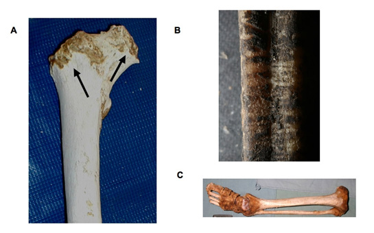 Animal scavenging marks on bones from dead bodies